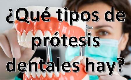 Perca lápiz Hipócrita Qué tipos de prótesis dentales hay?